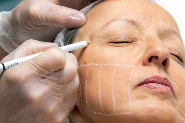 CryoPen: 5 Skin Concerns It May Be Used to Treat 4 What should you ask before having CryoPen treatment Oxfordshire?