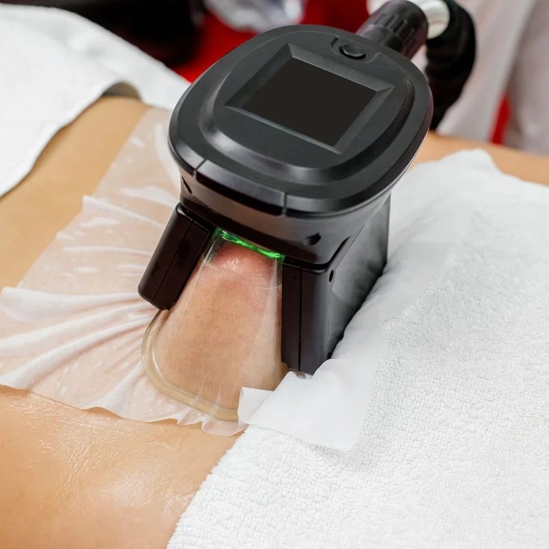 Fat Freezing treatment Oxfordshire